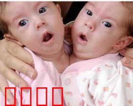 异于常人：连体人