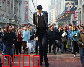 异于常人：巨人症